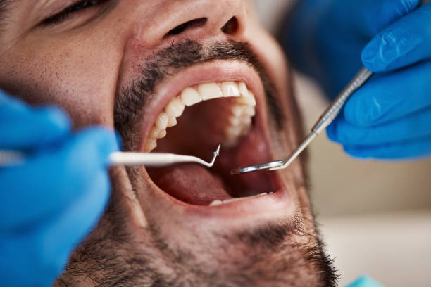 Best Urgent Dental Care  in Stonewall, MS